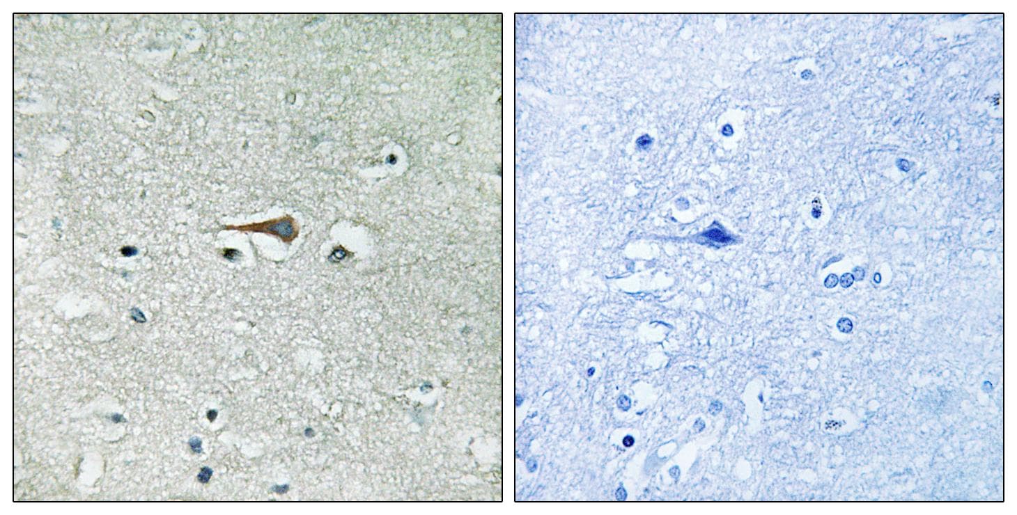 MPS1 / TTK Antibody (p676)