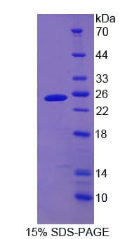 Human CYGB / Cytoglobin Protein (Recombinant His-T7)