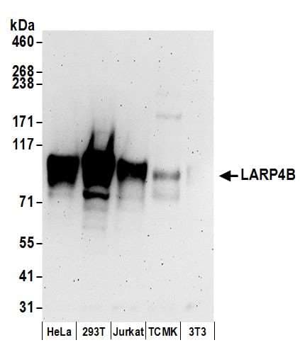 Polyclonal Rabbit anti-Human LARP4B Antibody (aa600-650, WB)