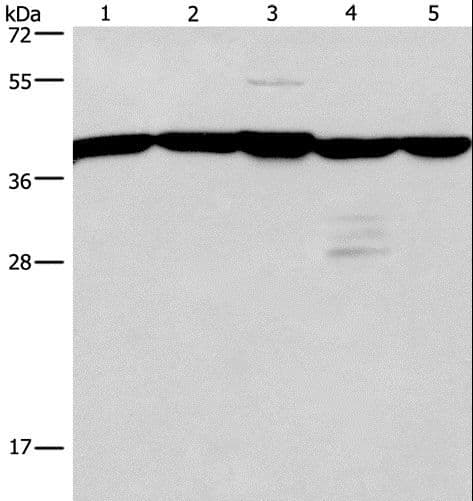Polyclonal Rabbit anti-Human GNA13 Antibody (IHC, WB)