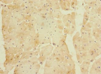 Polyclonal Rabbit anti-Human LYRM5 Antibody