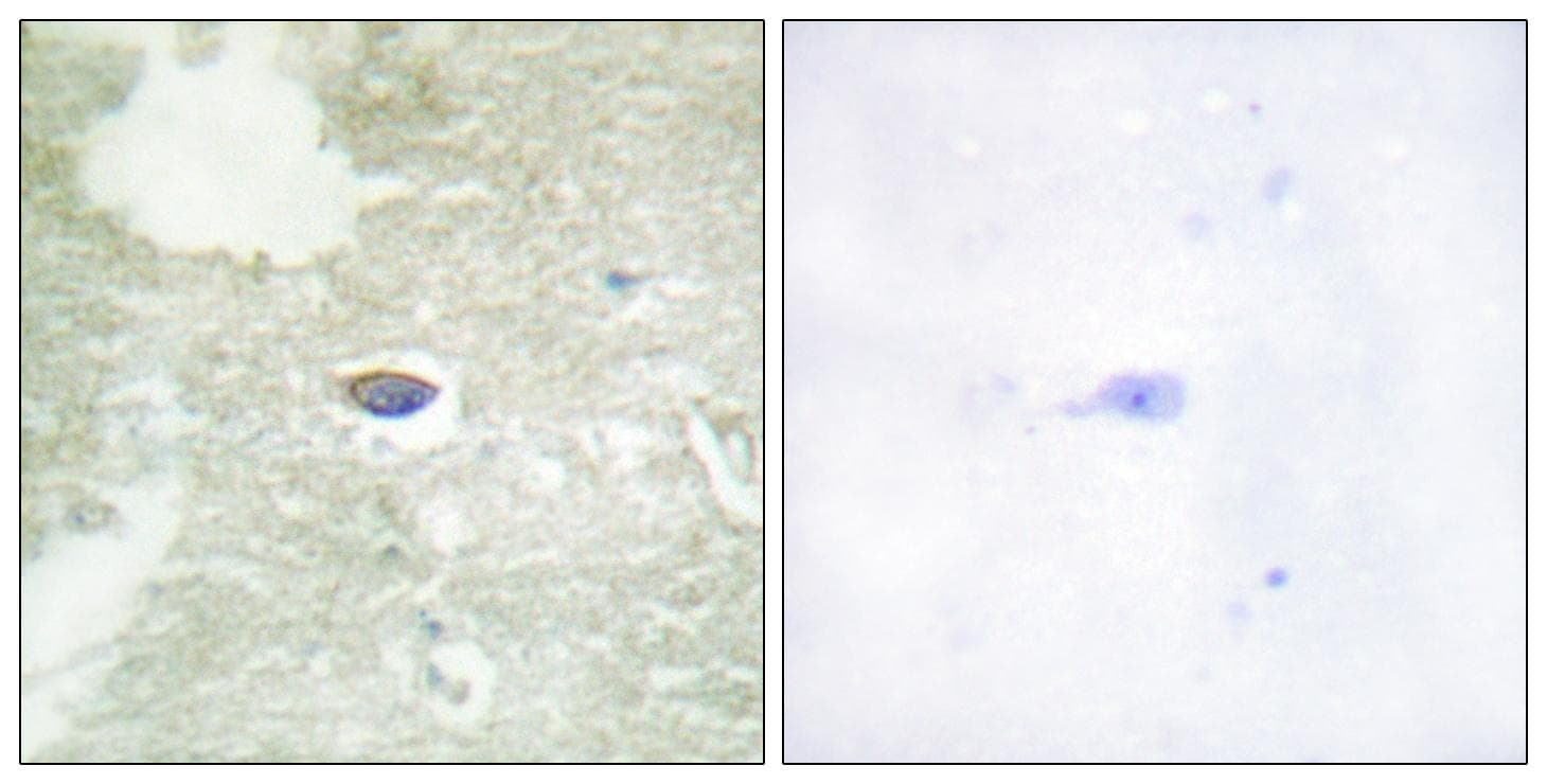 TGFBR2 Antibody (phospho-Ser225/250)