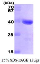 Human GAL4 / Galectin 4 Protein (Recombinant His)