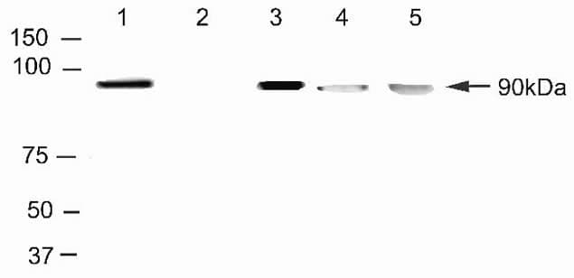 TOP1 / Topoisomerase I Antibody (N-Terminus, clone 24.5)