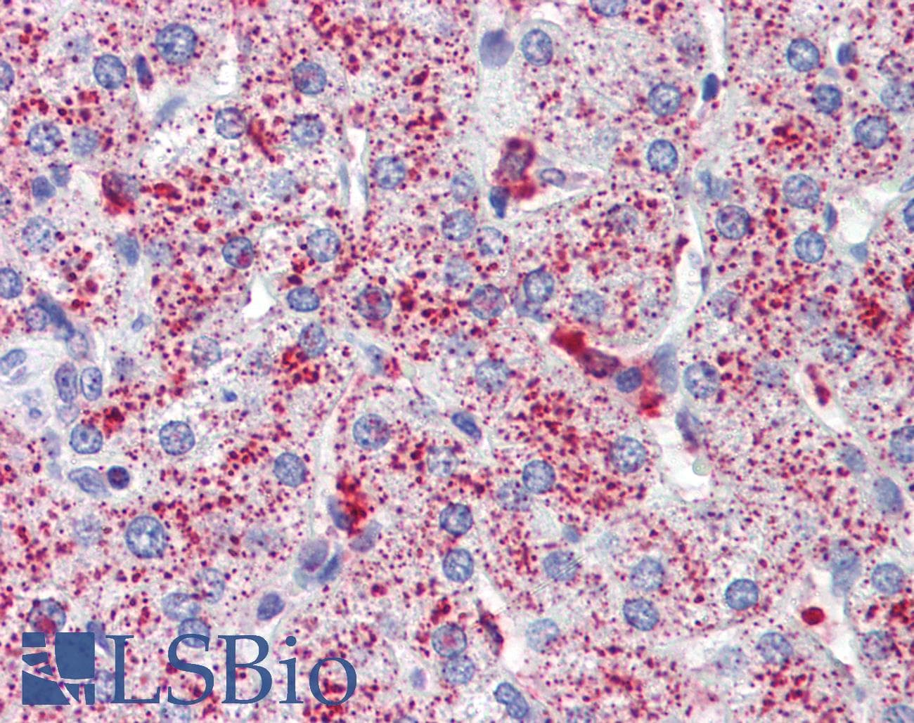SP4 Antibody (C-Terminus)