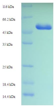 Human CDK5 Protein (Recombinant His-SUMO)