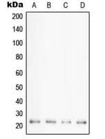 PPIF / Cyclophilin F Antibody (Internal)