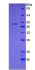 Rat F3 / CD142 / Tissue factor Protein (Recombinant His, N-Terminal)