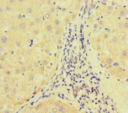 Polyclonal Rabbit anti-Human E2F1 Antibody (IHC, WB)