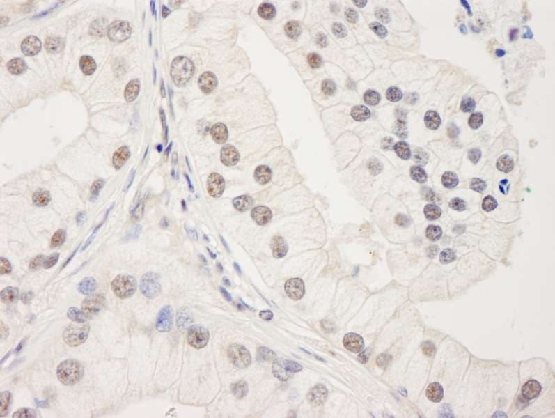 UACA Antibody (aa675-725)