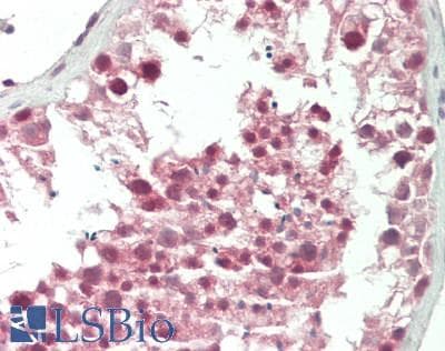 IHC-plus™ DAND5 Antibody (C-Terminus)