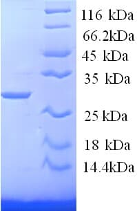 Mouse Tryptase Protein (Recombinant His)