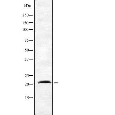 Dynactin 3 / DCTN3 Antibody