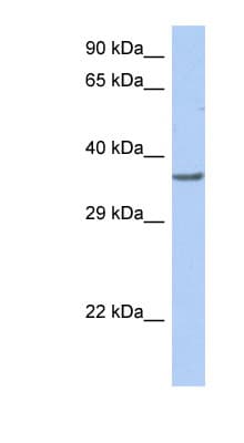 Polyclonal Rabbit anti-Human TFDP1 Antibody (C-Terminus, WB)