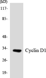 CCND1 / Cyclin D1 Antibody (aa37-86)