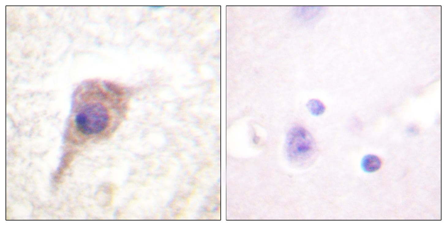 PRKCZ / PKC-Zeta Antibody (phospho-Thr560)