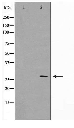 KDELR3 Antibody