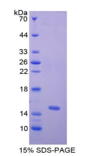 Human NPHS1 / Nephrin Protein (Recombinant His, N-terminus)