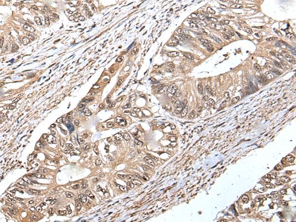 Polyclonal Rabbit anti-Human CREBL1 / ATF6B Antibody (IHC, WB)
