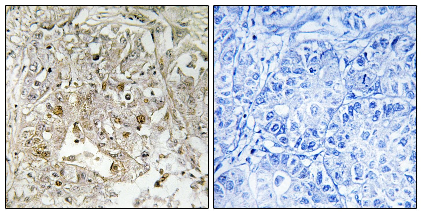 MAPK14 / p38 Antibody (Ab-179/181)