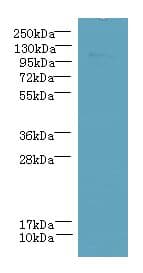 PPFIBP2 Antibody