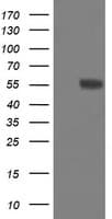 Monoclonal Mouse anti-Human FTCD / 58K Golgi Protein Antibody (clone OTI8F12, WB)