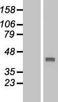 TBC1D21 Protein (Over-Expression Lysate Myc-DDK (Flag))