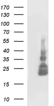 TNF Alpha Antibody (clone OTI1D9)