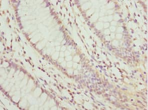 Polyclonal Rabbit anti-Human TGFB4 / LEFTY2 Antibody (IHC, WB)
