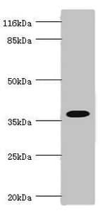 FBP1 Antibody
