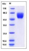 Mouse Sirpb1a Protein (Recombinant His,C-terminus)