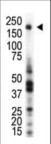 Polyclonal Rabbit anti-Human MST1R / RON Antibody (WB)