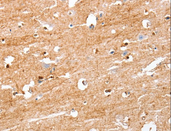 Polyclonal Rabbit anti-Human S100B / S100 Beta Antibody (IHC)