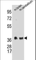 Polyclonal Rabbit anti-Human SYP / Synaptophysin Antibody (aa225-253, IHC, IF, WB)