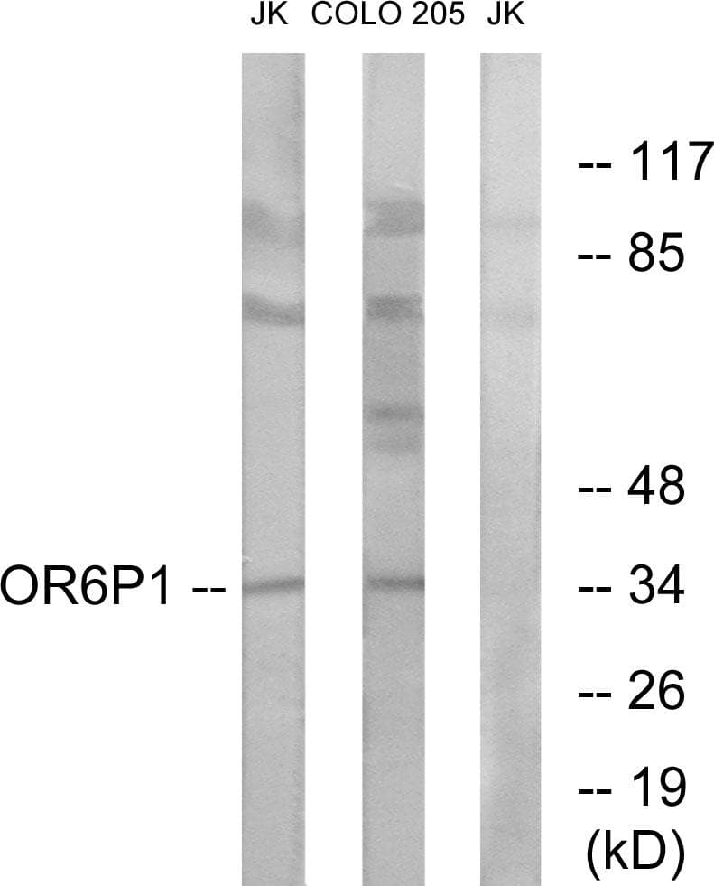 Polyclonal Rabbit anti-Human OR6P1 Antibody (WB)