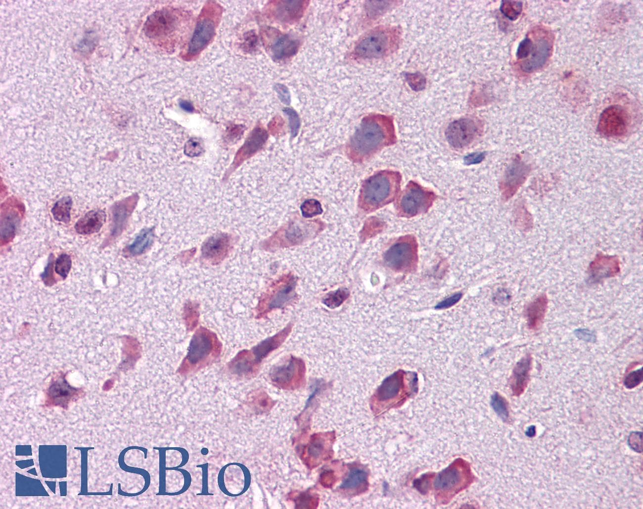 IHC-plus™ Monoclonal Rat anti-Mouse LAMP1 / CD107a Antibody (FITC, IHC, WB)