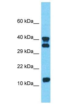 Polyclonal Rabbit anti-Human Calgizzarin / S100A11 Antibody (aa21-70, WB)
