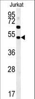 SAMSN1 Antibody (aa255-283)