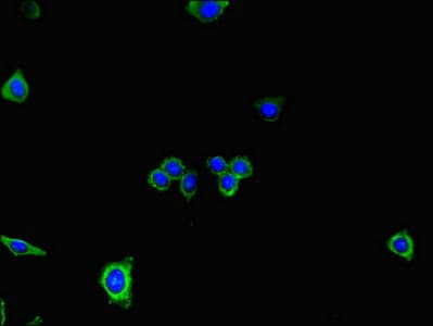 Polyclonal Rabbit anti-Human DNAH7 Antibody (IF)
