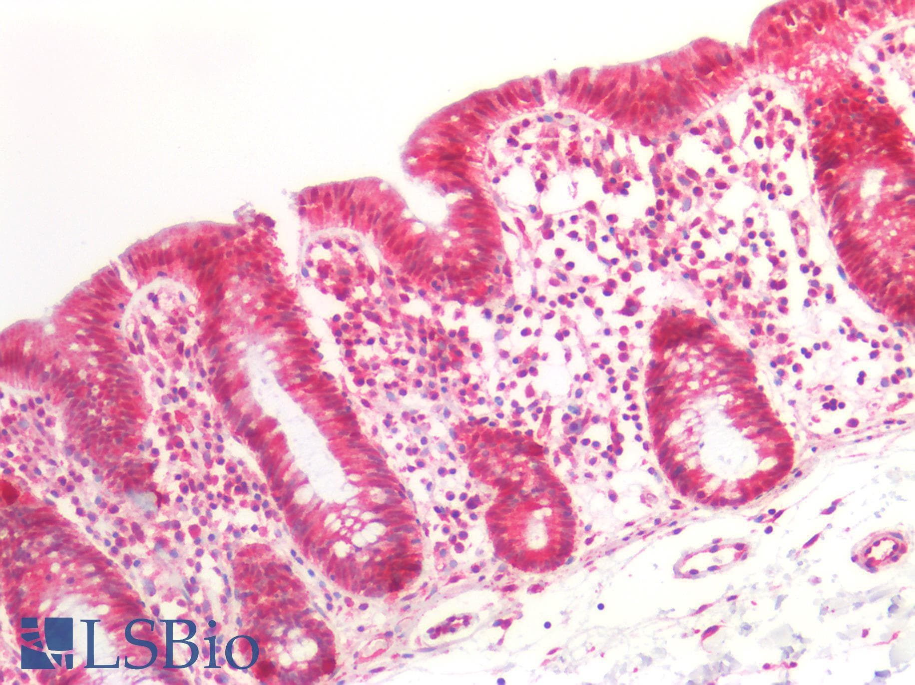 PathPlus™ CX3CL1 / Fractalkine Antibody