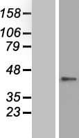 ZNF696 Protein (Over-Expression Lysate Myc-DDK (Flag))