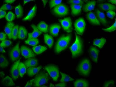Polyclonal Rabbit anti-Human FCGR3B / CD16B Antibody (IF)
