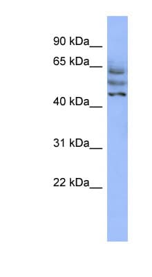 CCDC174 Antibody (aa215-264)