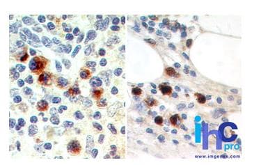 Monoclonal Mouse anti-Human EBI3 / IL-27B Antibody (clone 15k8D10, IHC, WB)