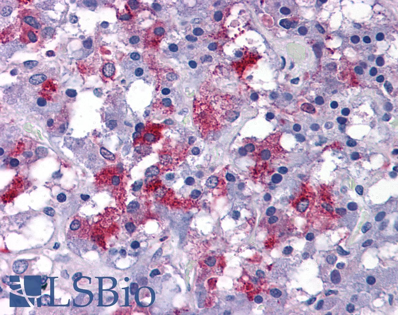 IHC-plus™ CRACR2A / EFCAB4B Antibody