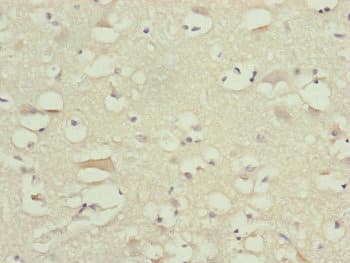 NDUFB10 Antibody