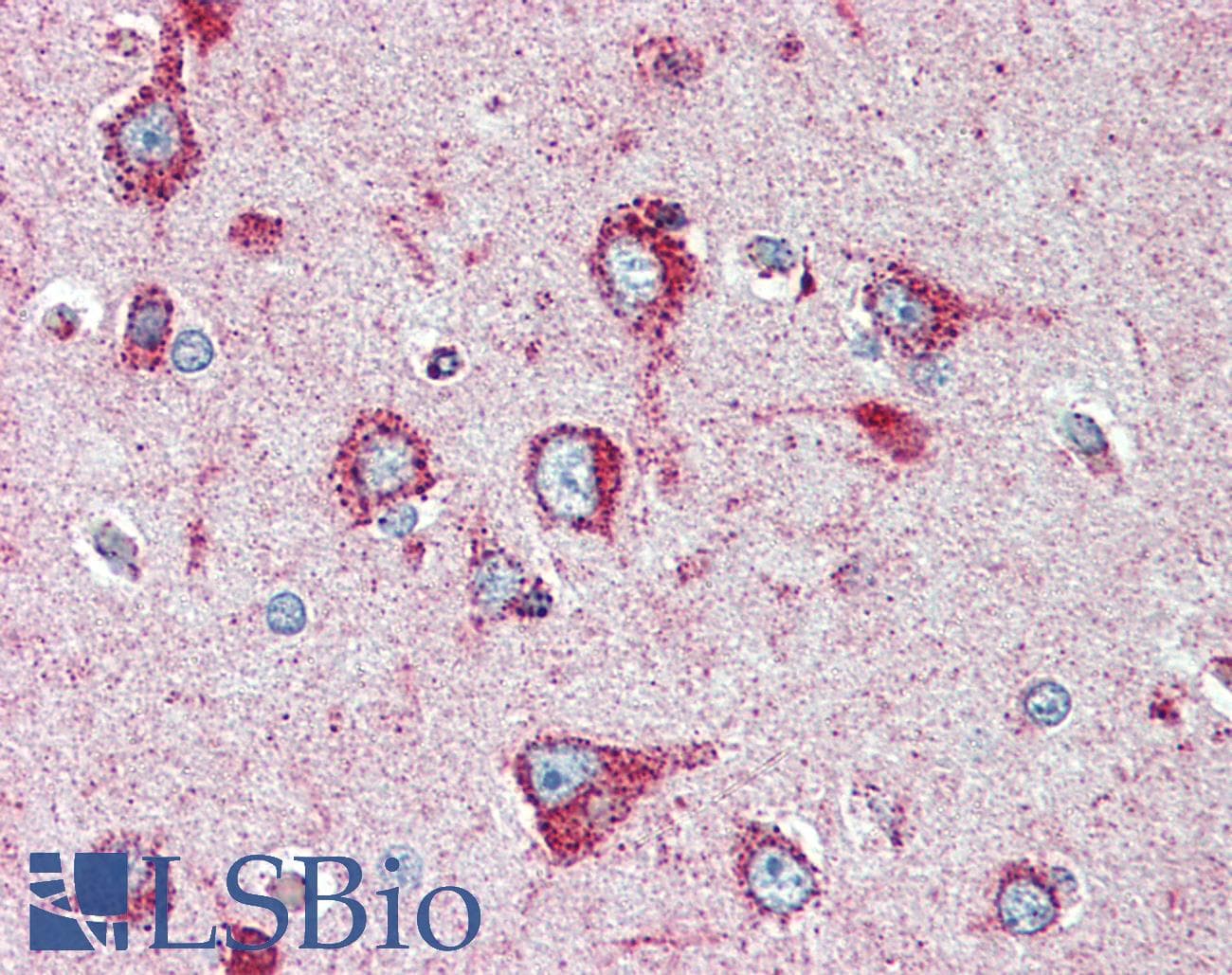 PathPlus™ SOD2 / Mn SOD Antibody