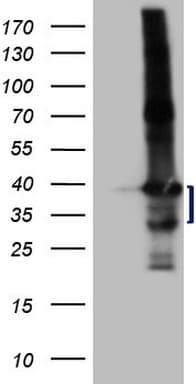 Monoclonal Mouse anti-Human LIME1 / LIME Antibody (clone OTI5D3, aa30-295, IHC, WB)