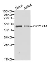 Polyclonal Rabbit anti-Human CYP17 / CYP17A1 Antibody (IHC, WB)
