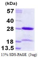 Human CBX5 / HP1 Alpha Protein (Recombinant His)